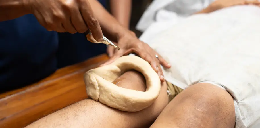 ආතරයිටිස් ප්‍රතිකාර